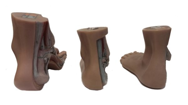 Santulli Orthopedie - voettypen achteraanzicht