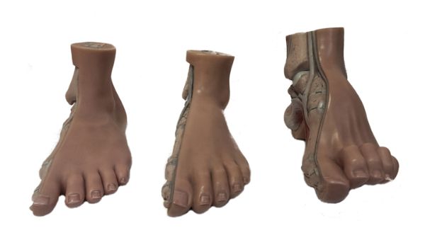 Santulli Orthopedie - voettypen vooraanzicht